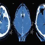 Rivoluzionare la Radiologia: Il Framework AI che Cambia le Regole del Gioco